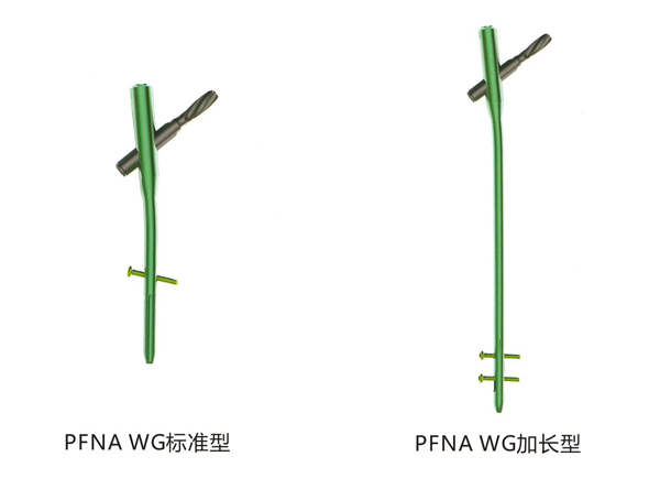 PFNA-WG股骨近端抗旋髓内钉